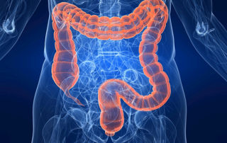 poliposi colon genetica