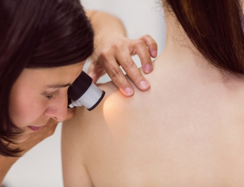 Il melanoma familiare ereditario: chiedilo al genetista