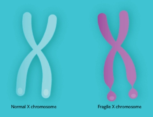 La Sindrome dell’X-Fragile: dalla diagnosi alla cura