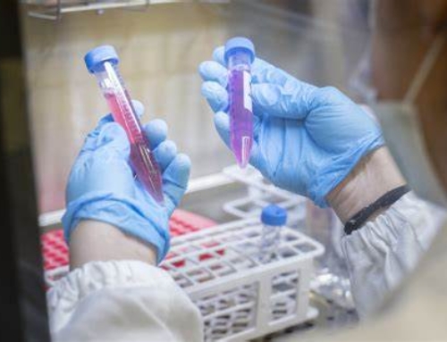 Malattie rare senza diagnosi: una sfida continua