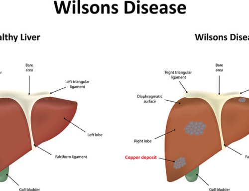 La malattia di Wilson: cause, sintomi e cura